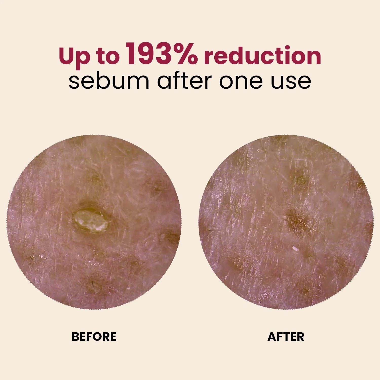 Sleekskin®Rice Glow Peel Shot