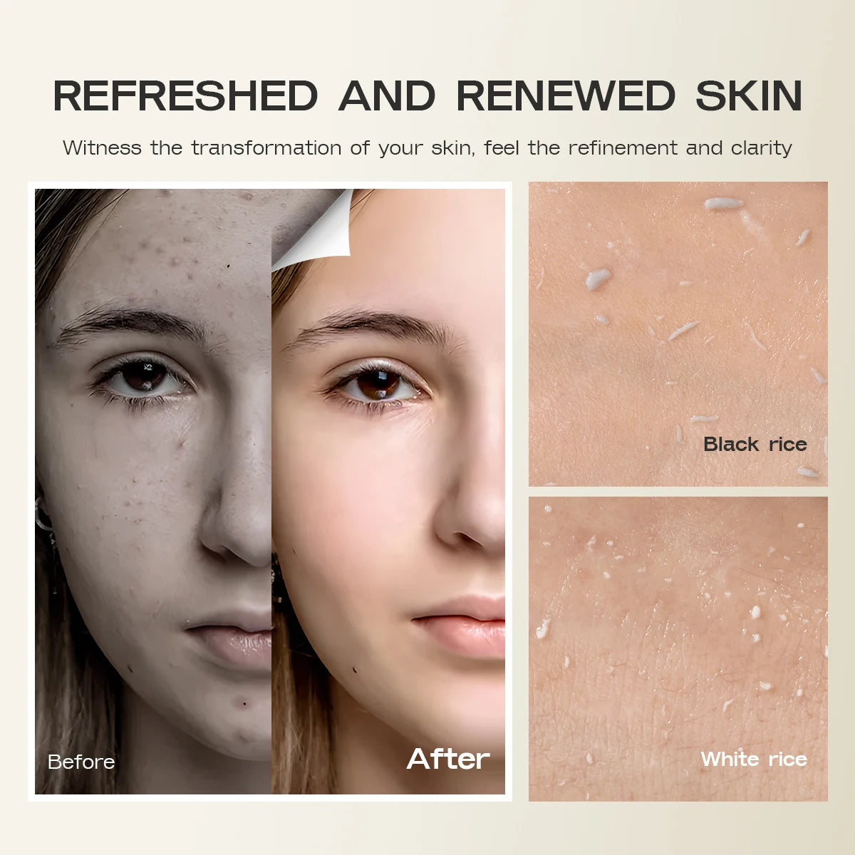 Sleekskin®Rice Glow Peel Shot
