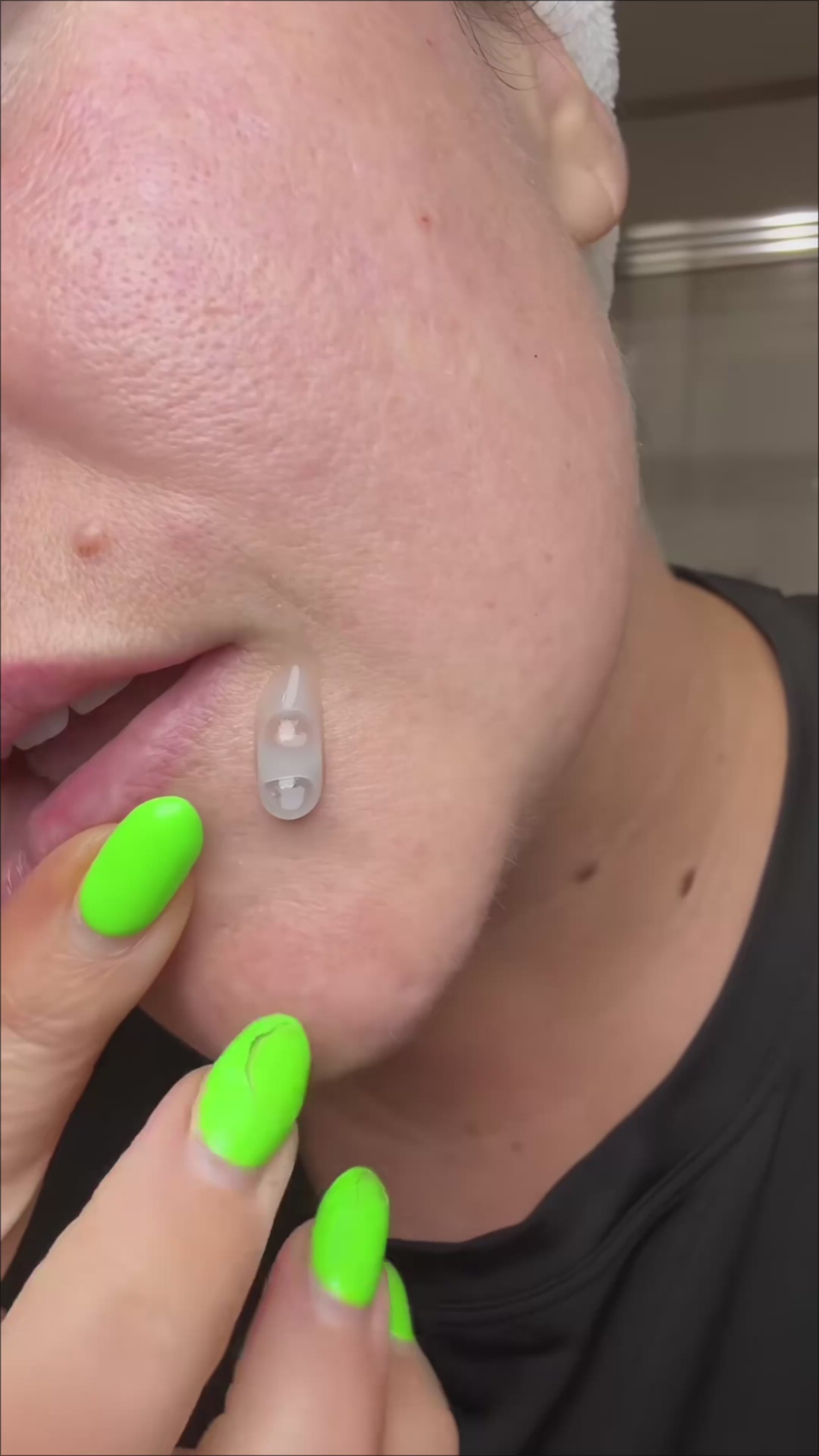 Sleekskin®Rice Glow Peel Shot